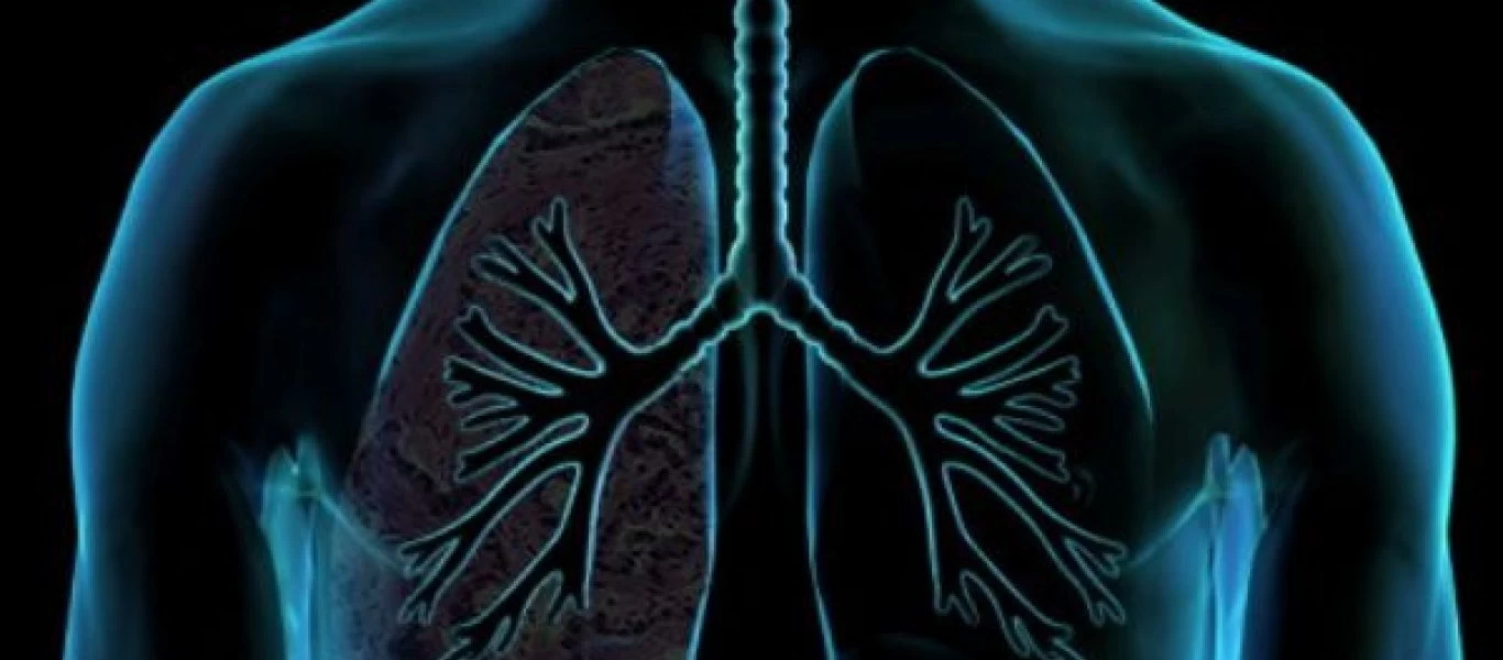 Όσα πρέπει να γνωρίζετε για το πνευμονικό οίδημα - Αναλυτικά όλα τα συμπτώματα